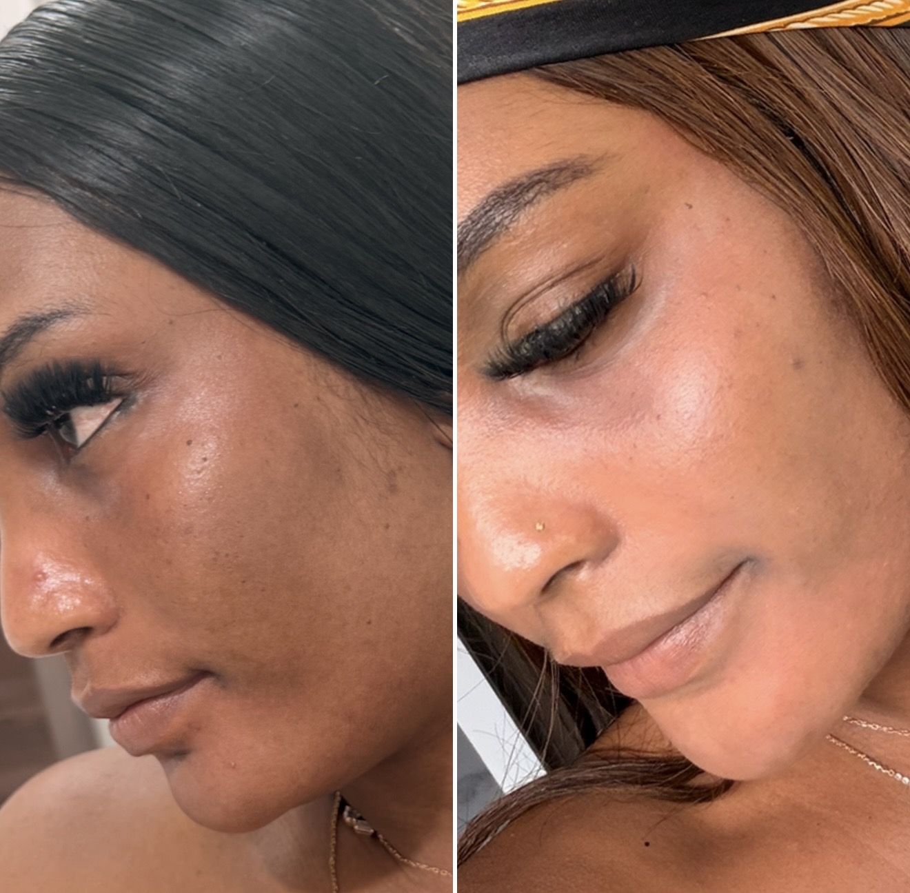 SkinRX Sun Protection Cream