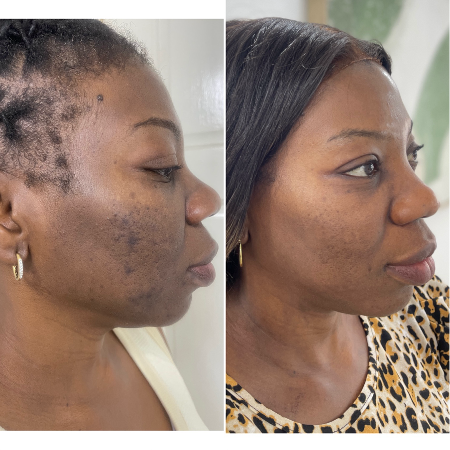 SkinRX sunscreen result
