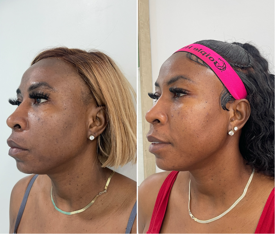 SkinRX sunscreen result