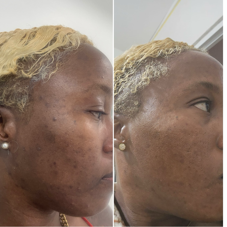 SkinRX sunscreen result