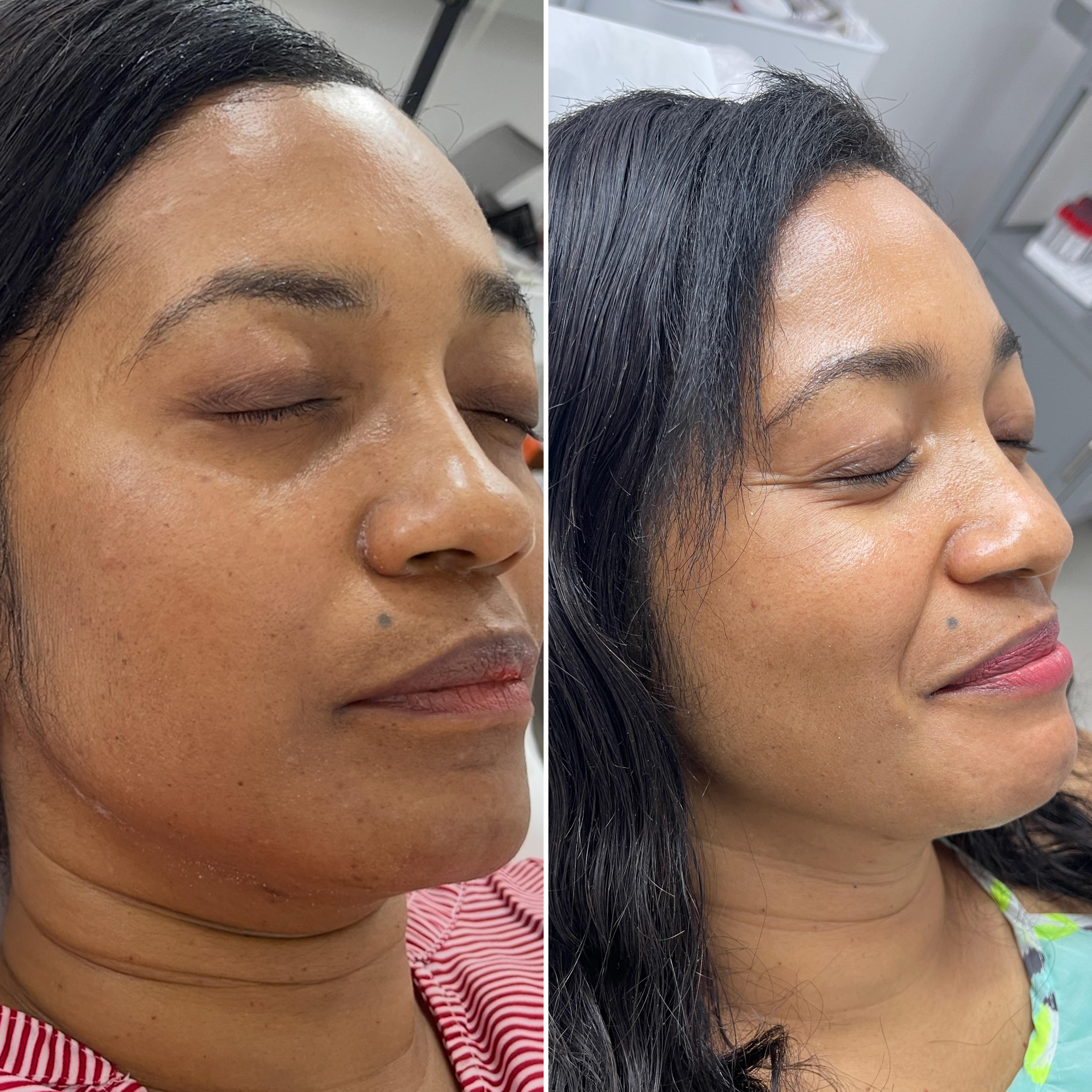 SkinRX sunscreen result