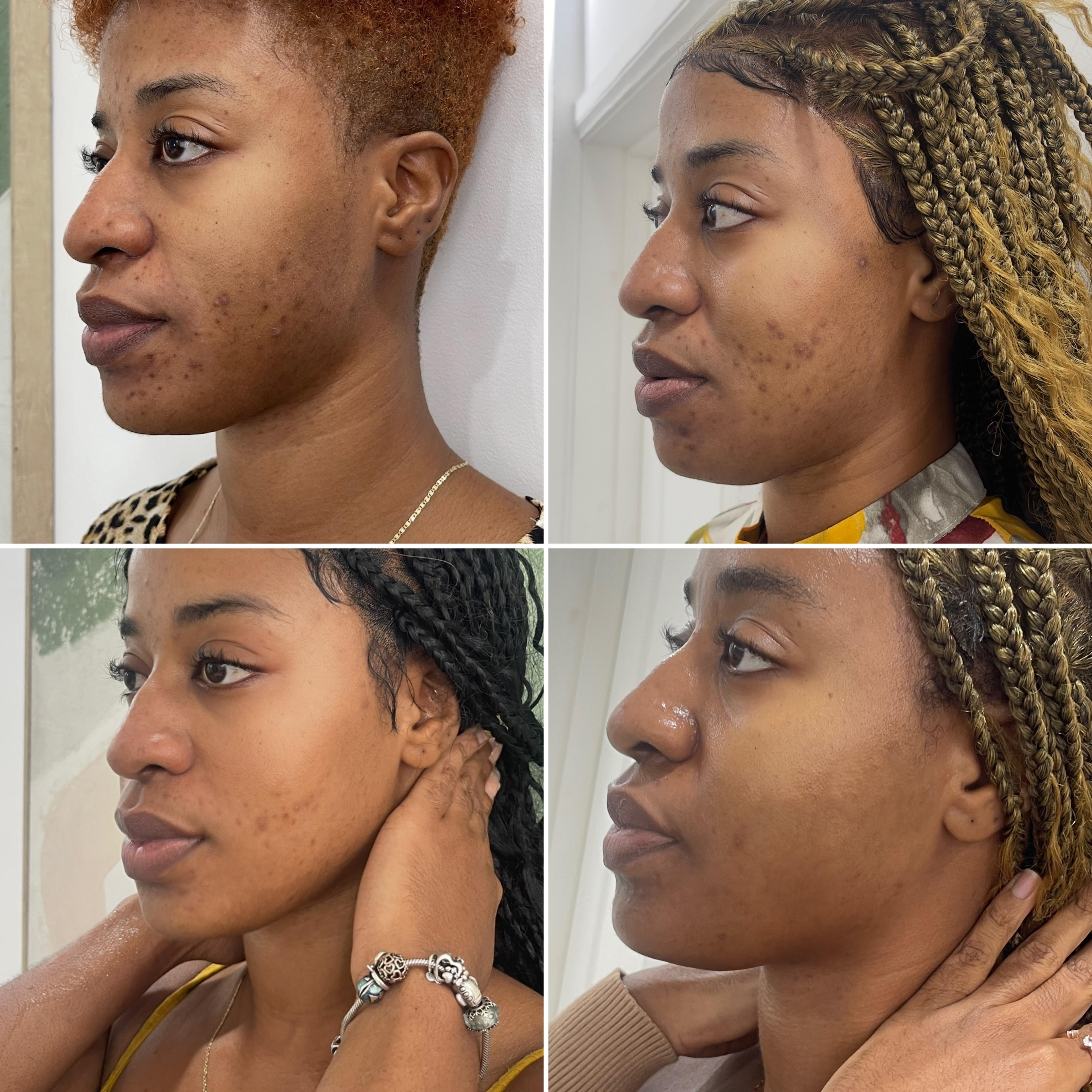 SkinRX sunscreen result